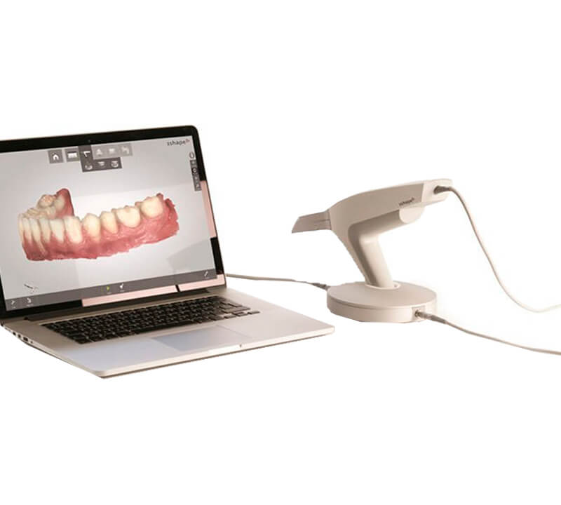 Scanner Intraoral Gasparini Odontologia Mooca Sp